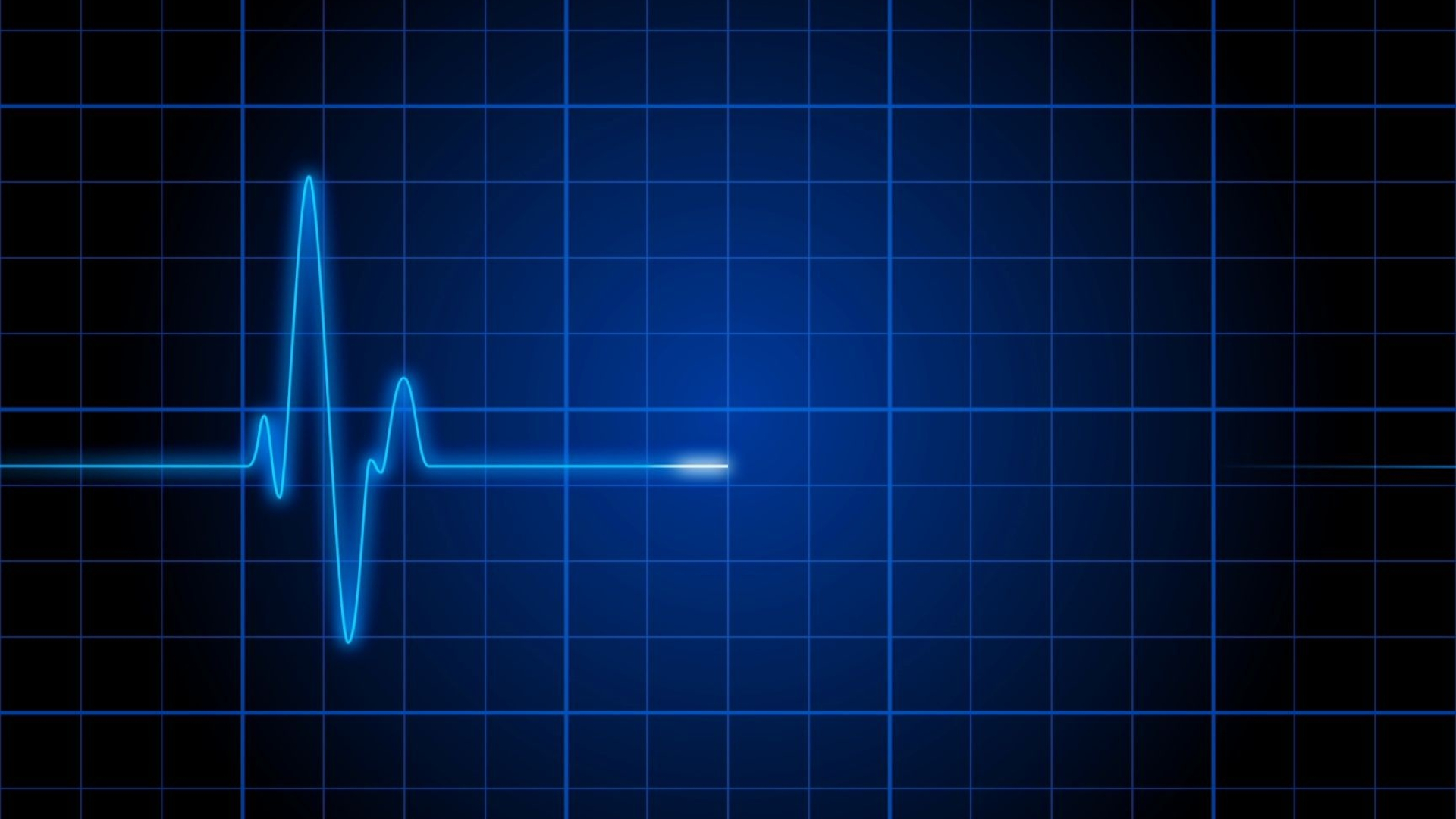 Heartbeat, EKG pattern, Medical symbolism, Cardiac health, 1920x1080 Full HD Desktop