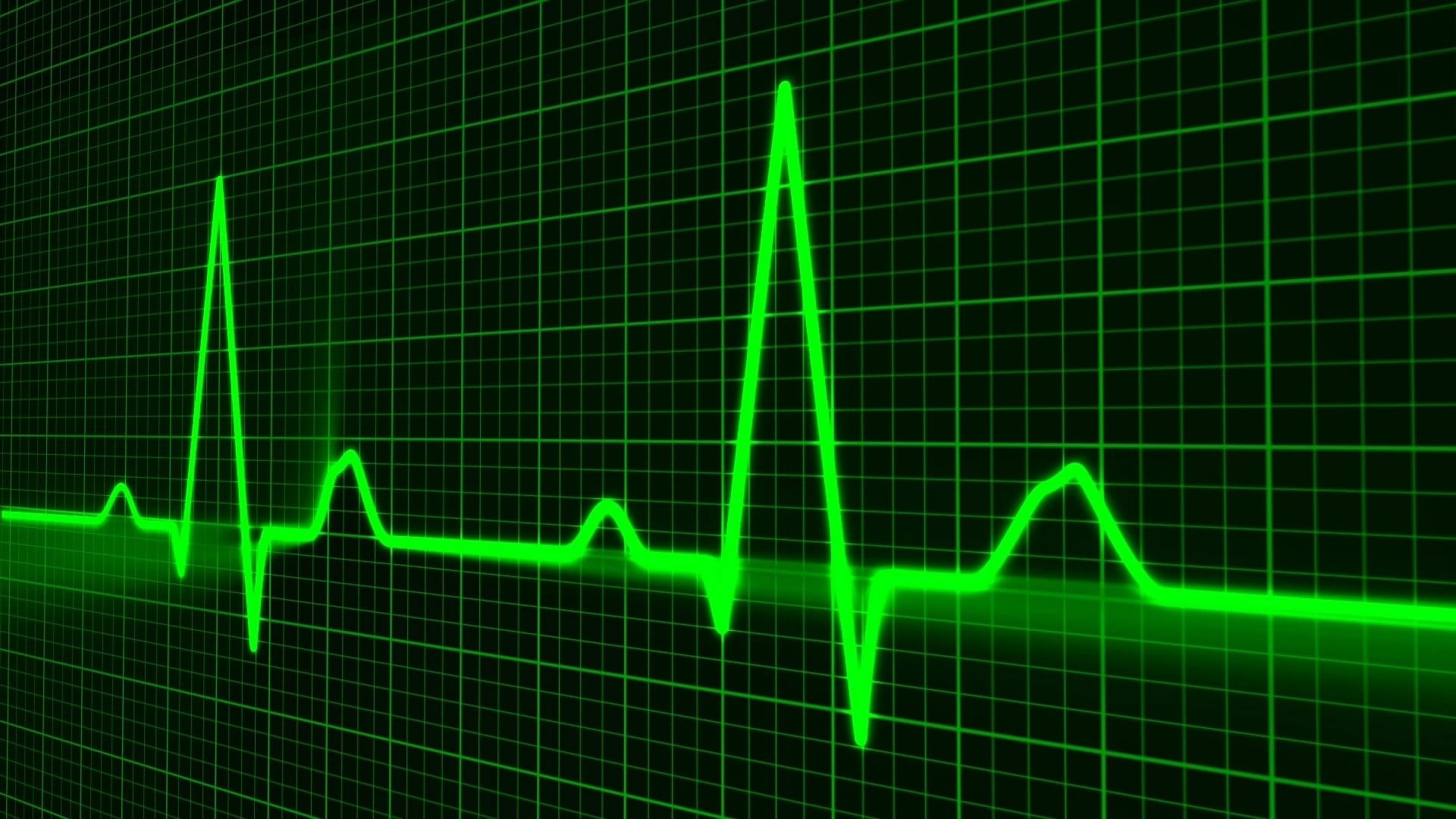 Heartbeat, Health monitoring device, Warnings and concerns, Medical technology, 1920x1080 Full HD Desktop